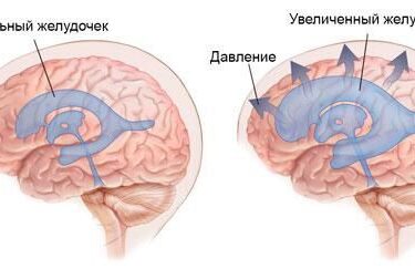 Биопсия (диагностика) 10 Херсон