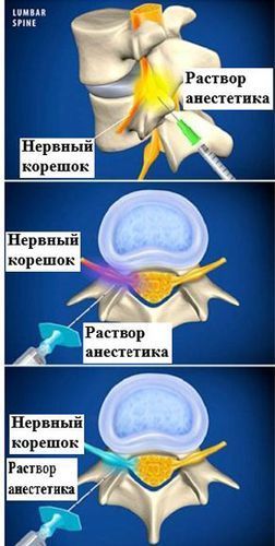 Реабилитационное лечение 5 фото neyroreabilitaciya dlya sayta 1