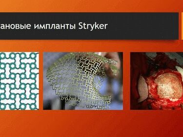 Краниопластика 12 Херсон
