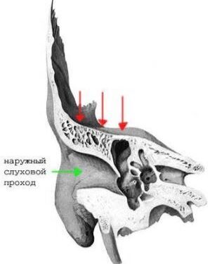 Диагностика ликвореи 5 Херсон