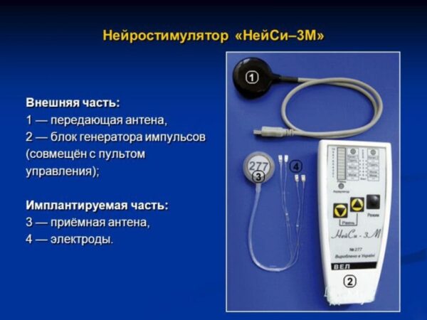 Херсонские нейрохирурги провели необычную операцию