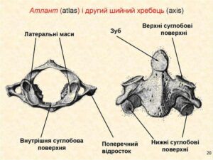 Анатомические особенности строения верхних 2 шейных позвонков