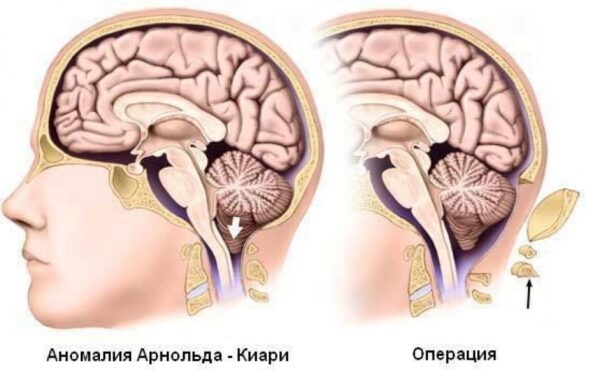 Впровадження новітніх технологій в нейрохірургії