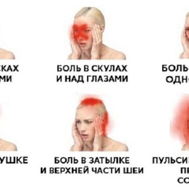 Головная боль 3 Херсон