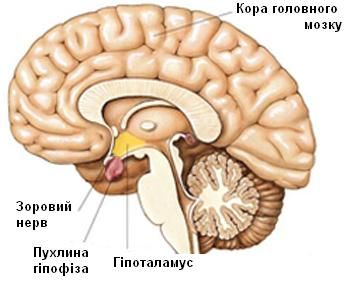 Онкологічні захворювання нервової системи 8 фото Онкологічні захворювання нервової системи 7 Херсон